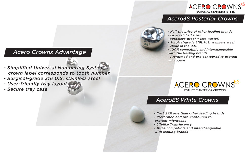 Acero advantage