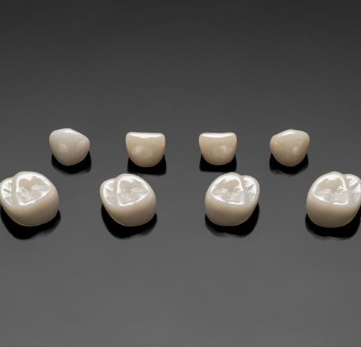 Acero Z1 Molar Kit