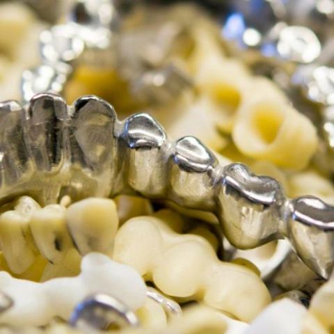 stainless steel crowns for adults