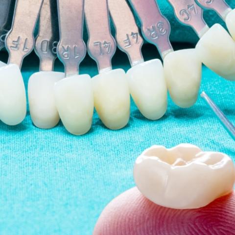 Zirconia Ceramic Crown