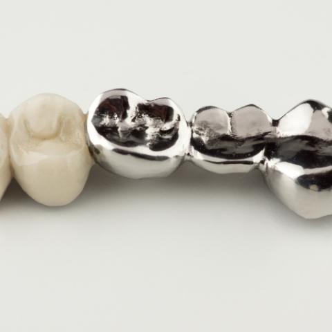 stainless steel crowns for adults