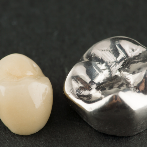 Stainless steel crowns for pediatric dentistry