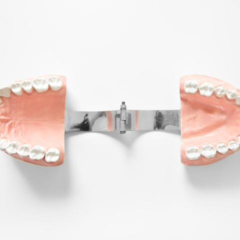 zirconia dental crown