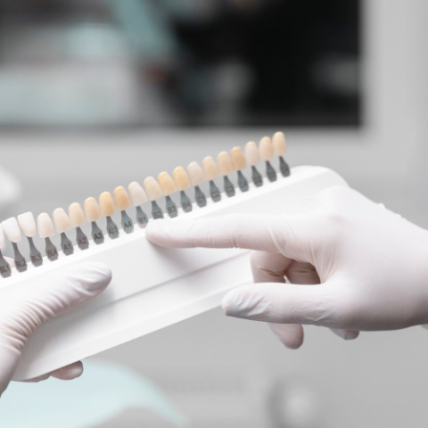 ¿Cómo se fabrican las coronas dentales?