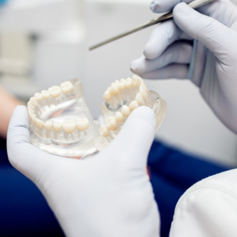 ¿Qué tan fuertes son las coronas de los dientes frontales?